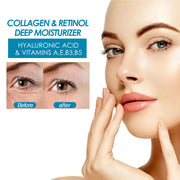 Retinol Renewal Moisture Cream 48 ml — product detail 4