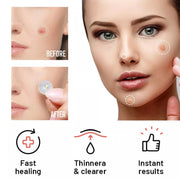 Chin Blemish Care Patches product detail image 3