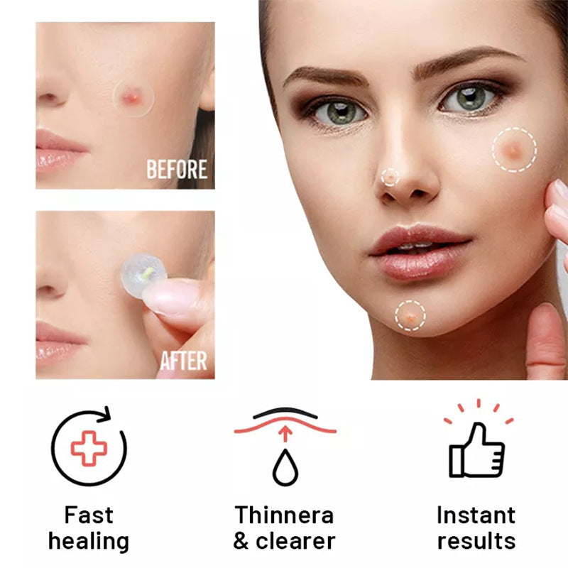 Chin Blemish Care Patches product detail image 3
